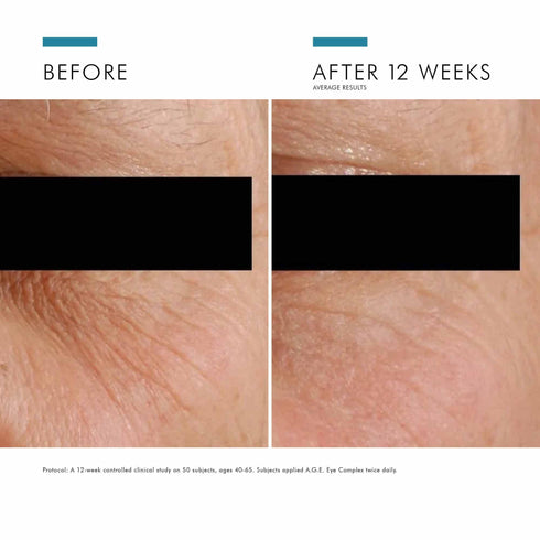 SKIN CEUTICALS | A.G.E. Complex Anti-Wrinkle Eye Cream
